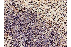 Immunohistochemistry analysis of human spleen tissue using ABIN7161498 at dilution of 1:100 (NCF2 antibody  (AA 178-526))