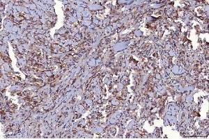 IHC analysis of CD147/Emmprin using anti-CD147/Emmprin antibody (ABIN7599998).