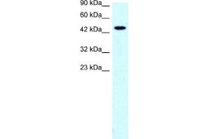 WB Suggested Anti-SLC17A2 Antibody Titration:  0. (SLC17A2 antibody  (Middle Region))