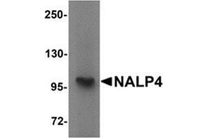 Western blot analysis of NALP4 in K562 cell lysate with NALP4 antibody at 1 μg/ml. (NLRP4 antibody  (Center))