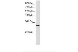 Image no. 1 for anti-AIMP1 / EMAP II (AA 31-80) antibody (ABIN6736246) (AIMP1 / EMAP II (AA 31-80) antibody)