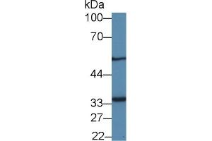 Western Blot; Sample: Human jurkat cell lysate; Primary Ab: 1µg/ml Rabbit Anti-Human MTX1 Antibody Second Ab: 0.