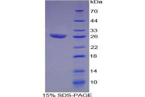 SDS-PAGE analysis of Human ATF1 Protein. (AFT1 Protein)