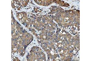 IHC analysis of FADS1 using anti-FADS1 antibody (ABIN7599175). (FADS1 antibody  (AA 1-257))