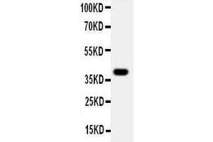 Western Blotting (WB) image for anti-Mucosal Vascular Addressin Cell Adhesion Molecule 1 (MADCAM1) (AA 173-190), (Middle Region) antibody (ABIN3044076) (MADCAM1 antibody  (Middle Region))