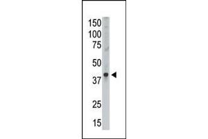 The anti-GEA9 Ctr Antibody (ABIN390111 and ABIN2840622) is used in Western blot to detect GEA9 in Placenta lysate. (MAGEA9 antibody  (AA 171-198))