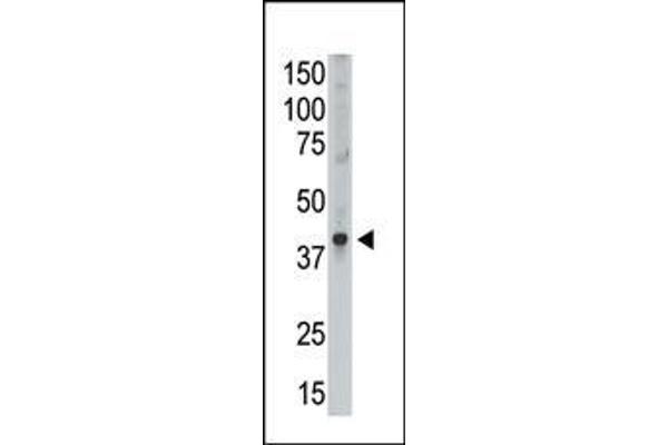 MAGEA9 antibody  (AA 171-198)