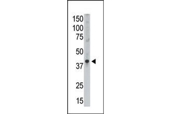 MAGEA9 antibody  (AA 171-198)