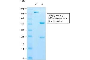 SDS-PAGE Analysis of Purified Cytokeratin 10 Rabbit Recombinant Monoclonal Antibody (KRT10/1990R). (Recombinant Keratin 10 antibody)