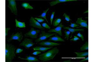 Immunofluorescence of purified MaxPab antibody to PKNOX1 on HeLa cell. (PKNOX1 antibody  (AA 1-436))