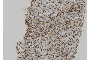 ABIN6264680 and ABIN6272412 at 1/100 staining Human spleen tissue by IHC-P. (RCC2 antibody  (C-Term))