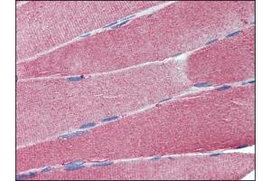 Immunohistochemistry: Human Skeletal Muscle: Formalin-Fixed, Paraffin-Embedded (FFPE). (Cell Adhesion Molecule 4 antibody  (Internal Region))