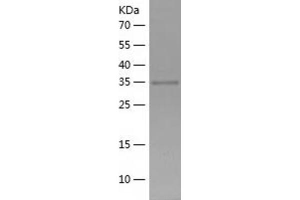 TEF Protein (AA 1-303) (His tag)