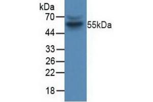 Detection of CCNB in Human Jurkat Cells using Polyclonal Antibody to Cyclin B (CCNB) (Cyclin B1 antibody  (AA 239-433))