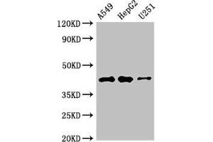 Western Blot Positive WB detected in: A549 whole cell lysate, HepG2 whole cell lysate, U251 whole cell lysate All lanes: B4GALT2 antibody at 3.