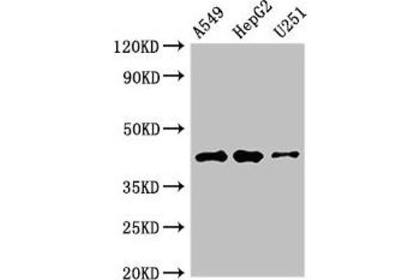 B4GALT2 anticorps  (AA 271-372)