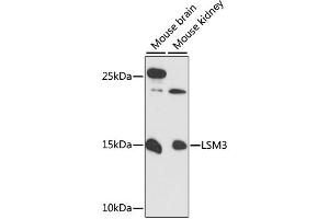 Western blot analysis of extracts of various cell lines, using LSM3 antibody (ABIN6292511) at 1:3000 dilution.