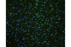 IF analysis of TPR using anti-TPR antibody (ABIN5693275) TPR was detected in paraffin-embedded section of mouse brain tissues. (TPR antibody)