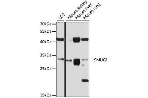 Western blot analysis of extracts of various cell lines, using SMUG1 antibody (ABIN4905242) at 1:1000 dilution. (SMUG1 antibody)