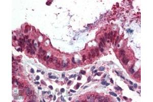 ABIN185664 (3. (Ezrin antibody  (Internal Region))