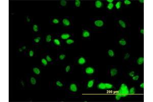 Immunofluorescence of monoclonal antibody to GATA2 on HeLa cell. (GATA2 antibody  (AA 1-102))