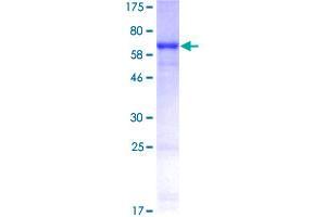 Cytokeratin 19 Protein (AA 1-400) (GST tag)