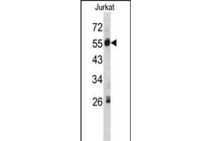 Western blot analysis of SERPING1 antibody (Center) (ABIN390620 and ABIN2840928) in Jurkat cell line lysates (35 μg/lane). (SERPING1 antibody  (AA 285-314))