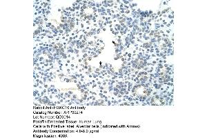 Human Lung (HOXC10 antibody  (N-Term))