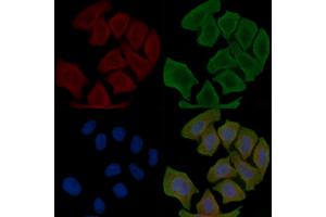 ABIN6266215 and ABIN6277373 staining Hela cells(30 min of UV treatment) by IF/ICC. (Connexin 31 antibody  (C-Term))