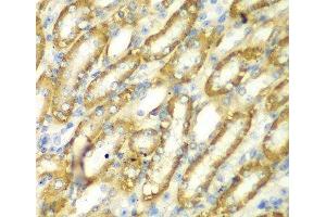 Immunohistochemistry of paraffin-embedded Mouse kidney using TM9SF1 Polyclonal Antibody at dilution of 1:100 (40x lens). (TM9SF1 antibody)