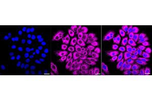 Immunocytochemical staining of HepG2 cells with Cytochrome P450 2C9 antibody (ABIN7798254), 1:1,000).