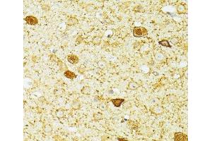 Immunohistochemistry of paraffin-embedded Mouse brain using PVALB Polyclonal Antibody at dilution of 1:100 (40x lens). (PVALB antibody)