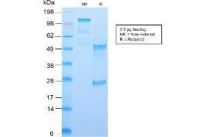 SDS-PAGE (SDS) image for anti-CD34 (CD34) antibody (ABIN6941175)