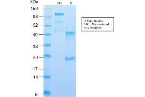 SDS-PAGE (SDS) image for anti-CD34 (CD34) antibody (ABIN6941175)