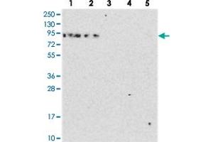 Western blot analysis of Lane 1: RT-4, Lane 2: U-251 MG, Lane 3: Human Plasma, Lane 4: Liver, Lane 5: Tonsil with DDX51 polyclonal antibody  at 1:250-1:500 dilution.