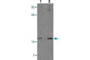 Western blot analysis of CISD2 in rat brain tissue with CISD2 polyclonal antibody  at (lane 1) 1 and (lane 2) 2 µg/m. (CISD2 antibody  (Internal Region))
