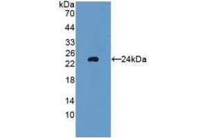 Western blot analysis of recombinant Rat GPX5. (GPX5 antibody  (AA 22-221))