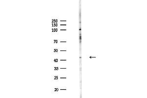 anti-Cysteine-Rich with EGF-Like Domains 2 (CRELD2) antibody