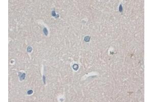 Immunohistochemistry (IHC) image for anti-Tumor Necrosis Factor Receptor Superfamily, Member 11a, NFKB Activator (TNFRSF11A) (AA 359-542) antibody (ABIN7439945)