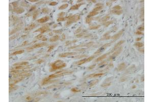 Immunoperoxidase of monoclonal antibody to HHIP on formalin-fixed paraffin-embedded human heart.