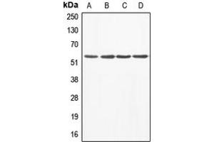 Western blot analysis of ABI1 expression in A549 (A), MCF7 (B), mouse liver (C), rat heart (D) whole cell lysates. (ABI1 antibody  (Center))