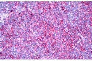Anti-HLA-DR antibody IHC staining of human thymus, medulla. (HLA-DR antibody)