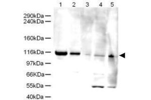 Image no. 1 for anti-ATPase Family, AAA Domain Containing 5 (ATAD5) (AA 63-76) antibody (ABIN401276) (ATAD5 antibody  (AA 63-76))