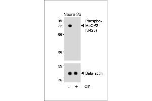 Western blot analysis of lysates from Neuro-2a cell line, untreated or treated with calf intestinal alkaline phosphatase(CIP), using Phospho-MeCP2 Antibody (upper) or Beta-actin (lower). (MECP2 antibody  (pSer423))