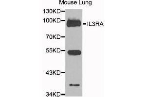 Western blot analysis of extracts of mouse lung cells, using IL3RA antibody. (IL3RA antibody)