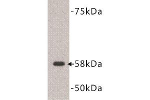 Western Blotting (WB) image for anti-Deoxynucleotidyltransferase, terminal (DNTT) (C-Term) antibody (ABIN1854983) (TdT antibody  (C-Term))