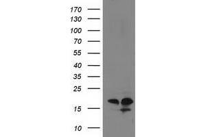 HEK293T cells were transfected with the pCMV6-ENTRY control (Left lane) or pCMV6-ENTRY DSTN (Right lane) cDNA for 48 hrs and lysed. (Destrin antibody)