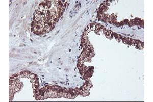 Image no. 10 for anti-Haloacid Dehalogenase-Like Hydrolase Domain Containing 1 (HDHD1) antibody (ABIN1498623)