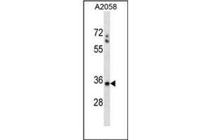 Western blot analysis of SPEM1 Antibody (Center) in A2058 cell line lysates (35ug/lane). (SPEM1 antibody  (Middle Region))