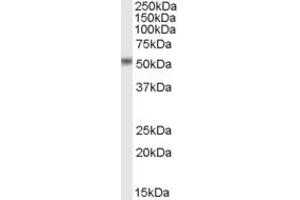 Western Blotting (WB) image for anti-STEAP Family Member 4 (STEAP4) (AA 441-456) antibody (ABIN297718) (STEAP4 antibody  (AA 441-456))